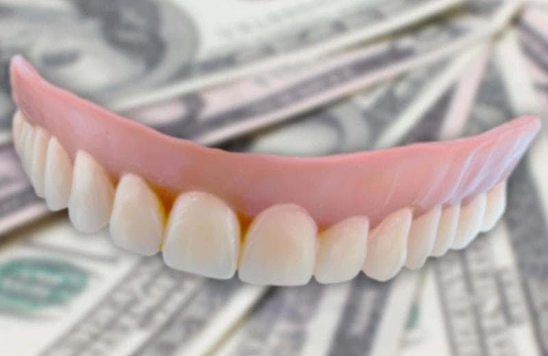 How Much Do Full Mouth Dental Implants Cost?