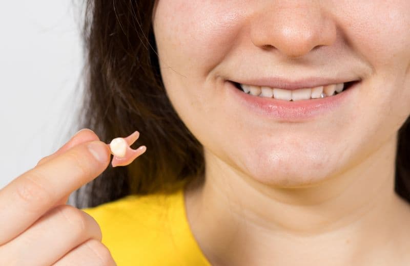 What Is a Dental Flipper and Why It’s Only a Temporary Solution for Your Missing Teeth