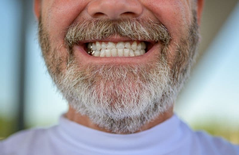 Why Affordable Dentures & Implants Offers Customizable Gold Crowns for Dentures Instead of Gold Dental Caps