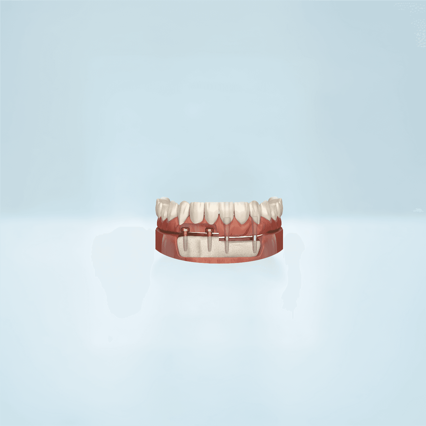 dentures